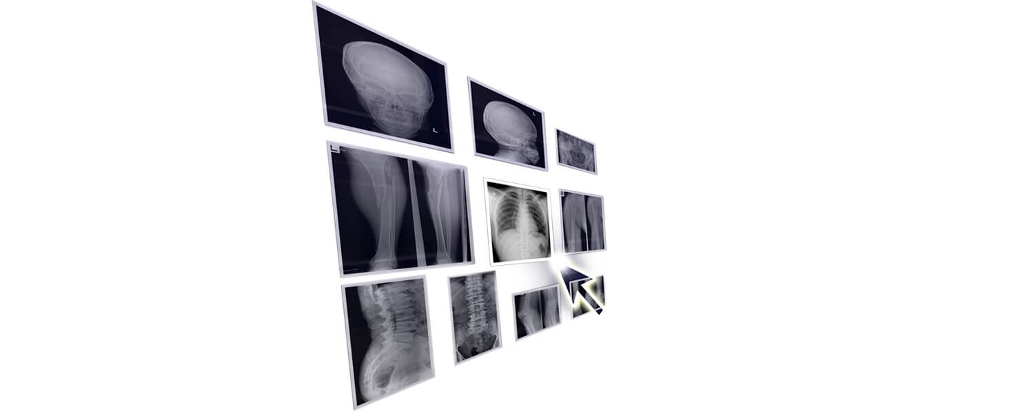 Almacenamiento escalable y acceso rápido a imágenes médicas con ActualPACS Imágenes radiológicas almacenadas en la nube (esquema PACS en nube)