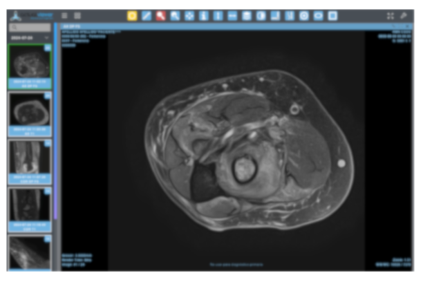 Exploración de resonancias magnéticas en el visor DICOM de ActualPACS Visor DICOM de ActualPACS mostrando una resonancia magnética