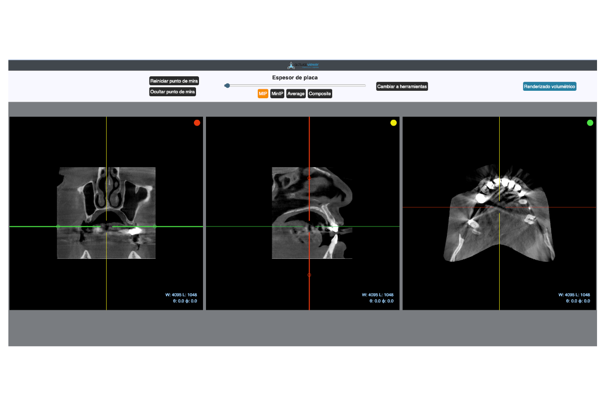 3-in-1 Dental X-Ray Viewer (ActualPACS Dental) DICOM viewer for dental images (multiplanar CT slices) in ActualPACS Dental
