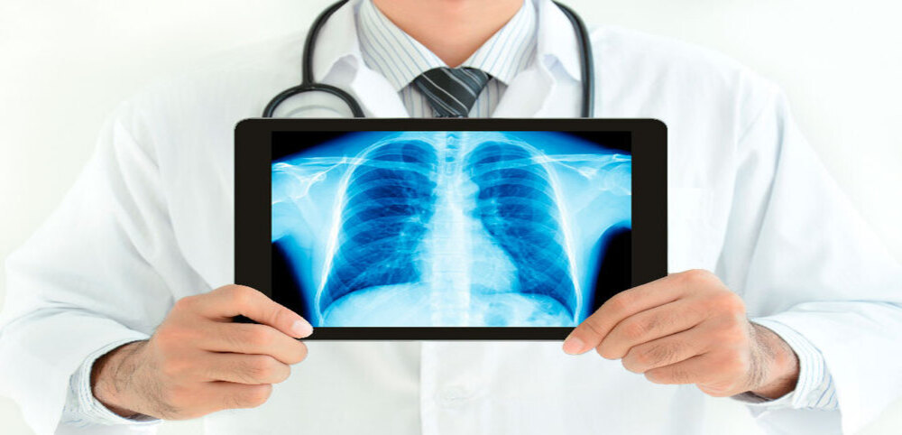 Visualización digital de radiografías (radiología en la nube) Radiografía de tórax mostrada en una tablet por un profesional sanitario